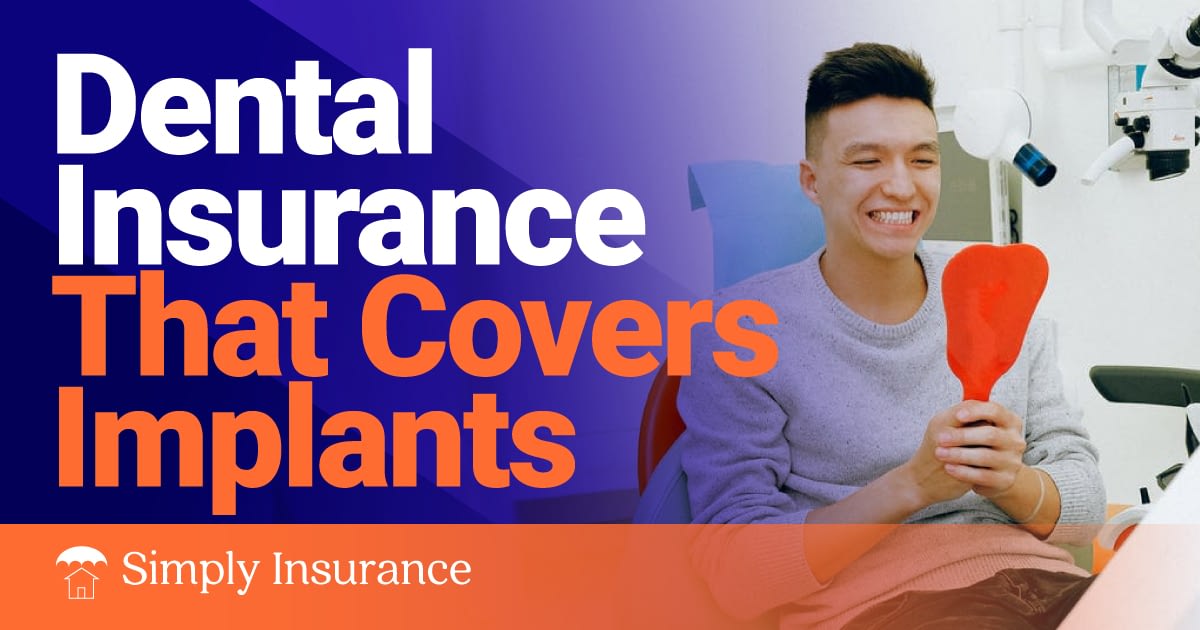 Dental insurance that covers implants 2020 // No waiting!